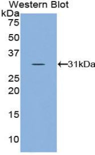 Polyclonal Antibody to Superoxide Dismutase, Copper Chaperone (SOD4)
