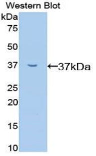 Polyclonal Antibody to V-Rel Reticuloendotheliosis Viral Oncogene Homolog A (RELA)