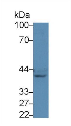Polyclonal Antibody to Tachykinin Receptor 2 (TACR2)