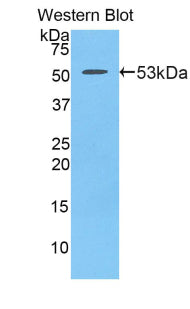 Polyclonal Antibody to Platelet Derived Growth Factor BB (PDGF BB)