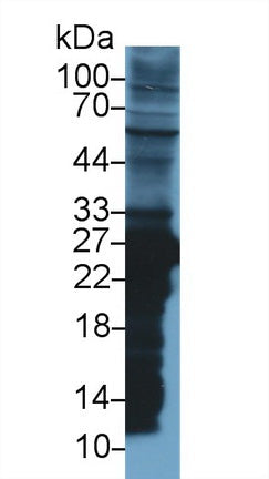 Polyclonal Antibody to Glutathione S Transferase Mu 2 (GSTM2)