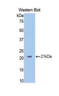 Polyclonal Antibody to Neuropilin 1 (NRP1)