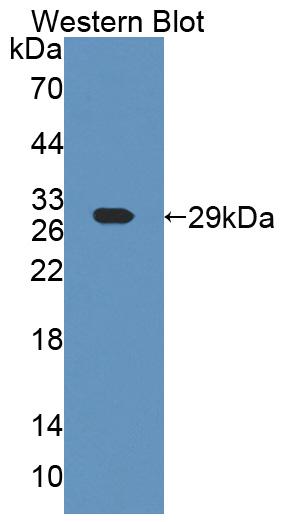 Polyclonal Antibody to ADP Ribosyltransferase 4 (ART4)