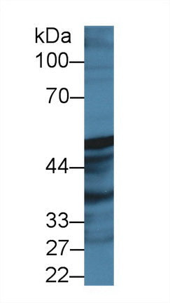 Polyclonal Antibody to Prostaglandin I Synthase (PTGIS)