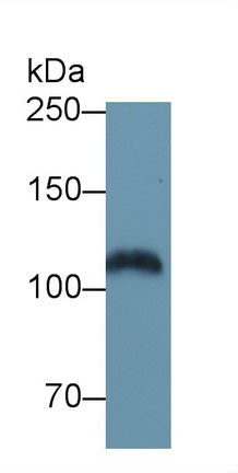 Polyclonal Antibody to Epidermal Growth Factor Receptor (EGFR)