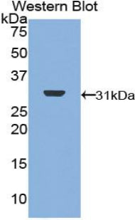 Polyclonal Antibody to Topoisomerase II (TOP2)