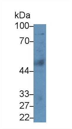 Polyclonal Antibody to Phospholipase A2 Group VII (LpPLA2)