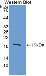 Polyclonal Antibody to Calcitonin Gene Related Peptide (CGRP)