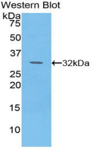 Polyclonal Antibody to Pyruvate Dehydrogenase Kinase 4 (PDK4)