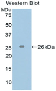Polyclonal Antibody to L1-Cell Adhesion Molecule (L1CAM)