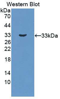 Polyclonal Antibody to Protein Tyrosine Phosphatase Receptor Type H (PTPRH)