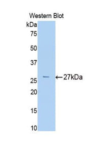 Polyclonal Antibody to Alpha-2-Macroglobulin (a2M)