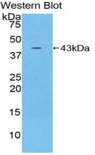 Polyclonal Antibody to Interleukin 12 Receptor Beta 2 (IL12Rb2)