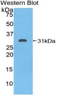 Polyclonal Antibody to Heat Shock 70kDa Protein 9 (HSPA9)
