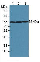 Polyclonal Antibody to Superoxide Dismutase 2, Mitochondrial (SOD2)