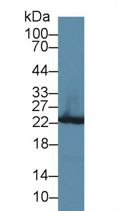 Polyclonal Antibody to Glutathione S Transferase Pi (GSTp)