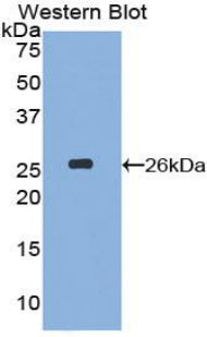 Polyclonal Antibody to Nucleoporin 133 (NUP133)