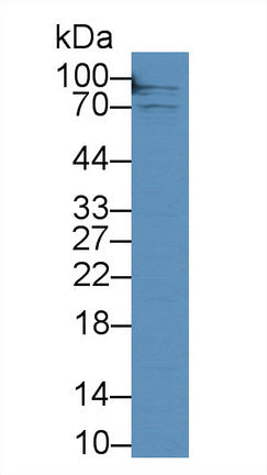 Polyclonal Antibody to Transferrin Receptor (TFR)