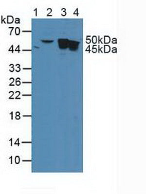 Polyclonal Antibody to Cytokeratin Fragment Antigen 21-1 (CYFRA21-1)