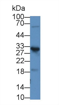 Polyclonal Antibody to Chymotrypsin C (CTRC)