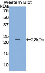 Polyclonal Antibody to Neutrophil gelatinase-associated lipocalin (NGAL)