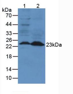 Polyclonal Antibody to Neutrophil gelatinase-associated lipocalin (NGAL)