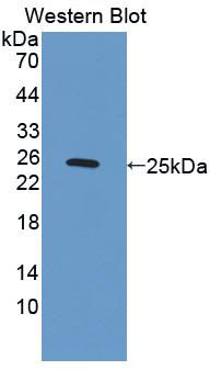 Polyclonal Antibody to Protease, Serine 12 (PRSS12)
