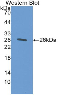 Polyclonal Antibody to Proteinase 3 (PR3)