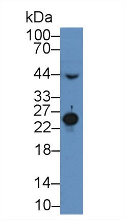 Polyclonal Antibody to Mannose Binding Lectin (MBL)