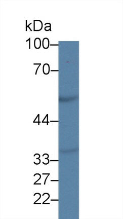 Polyclonal Antibody to Tumor Necrosis Factor Receptor 1 (TNFR1)