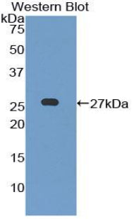 Polyclonal Antibody to Leukocyte Immunoglobulin Like Receptor Subfamily B, Member 3 (LILRB3)