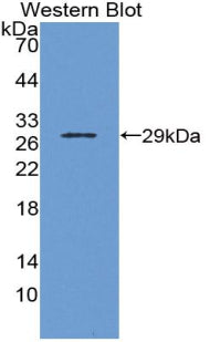 Polyclonal Antibody to Octamer Binding Transcription Factor 1 (OCT1)