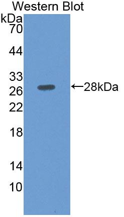 Polyclonal Antibody to Octamer Binding Transcription Factor 2 (OCT2)