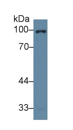 Polyclonal Antibody to Glucocorticoid Receptor (GR)