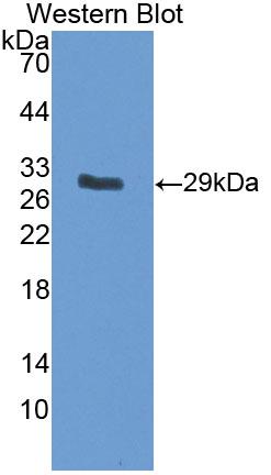 Polyclonal Antibody to Potassium Chloride Cotransporters 4 (KCC4)