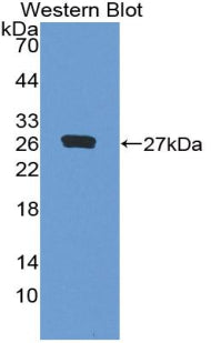 Polyclonal Antibody to MAP Kinase Activated Protein Kinase 3 (MAPKAPK3)