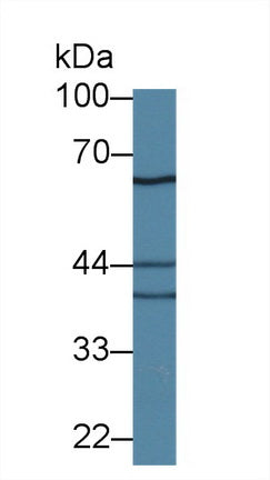 Polyclonal Antibody to Interleukin 18 Receptor 1 (IL18R1)