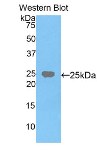 Polyclonal Antibody to Farnesyl Diphosphate Farnesyltransferase 1 (FDFT1)