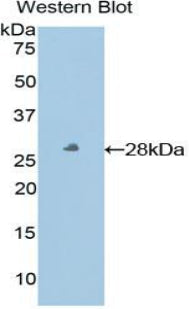 Polyclonal Antibody to Major Histocompatibility Complex Class I E (MHCE)