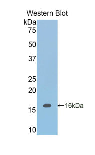 Polyclonal Antibody to Inhibin Beta B (INHbB)