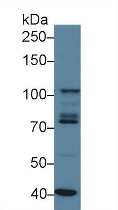 Polyclonal Antibody to Signal Transducer And Activator Of Transcription 2 (STAT2)