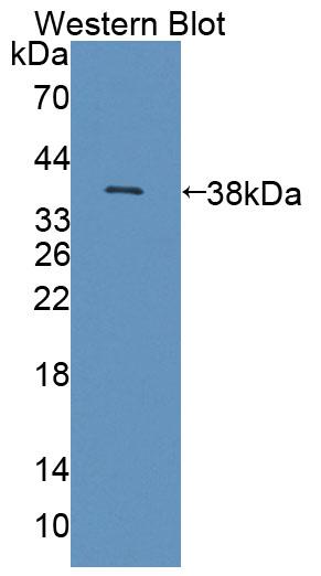 Polyclonal Antibody to Natural Cytotoxicity Triggering Receptor 2 (NCR2)