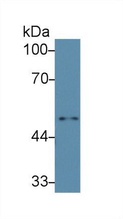 Polyclonal Antibody to Interleukin 6 Receptor (IL6R)