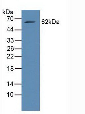 Polyclonal Antibody to V-Rel Reticuloendotheliosis Viral Oncogene Homolog B (RELB)