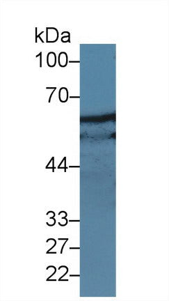 Polyclonal Antibody to Paxillin (PXN)