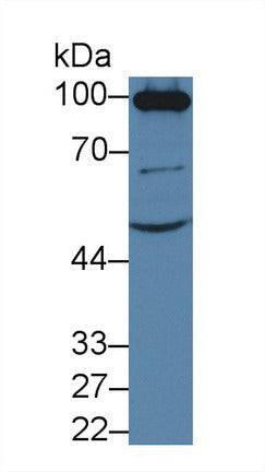 Polyclonal Antibody to Angiotensin I Converting Enzyme 2 (ACE2)