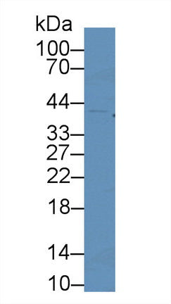 Polyclonal Antibody to Cyclin Dependent Kinase 2 (CDK2)