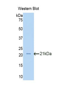Polyclonal Antibody to Oxidosqualene Cyclase (OSC)