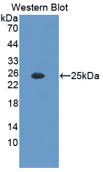 Polyclonal Antibody to Interleukin 35 (IL35)
