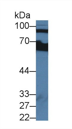 Polyclonal Antibody to Complement Factor B (CFB)